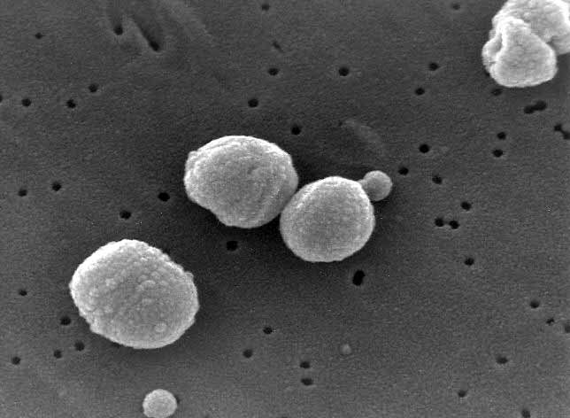 Streptococcus Amstelveen