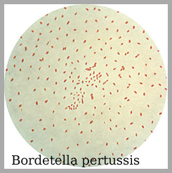 Bordetella Amstelveen